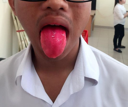 Quà vặt cổng trường: Ăn xong buồn nôn, khó chịu vẫn... ăn - ảnh 2