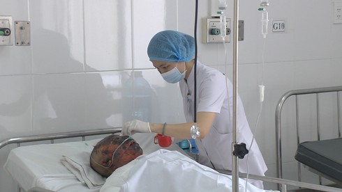 Nạn nhân bỏng nặng trong vụ tai nạn thảm khốc tại Bình Thuận đã tử vong - ảnh 1