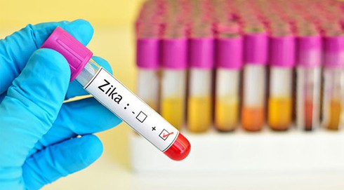 Có thêm 12 ca nhiễm Zika tại TP.HCM - ảnh 1