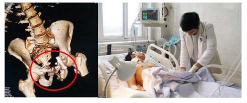 Hai nạn nhân nguy kịch được cứu sống nhờ trạm cấp cứu vệ tinh - ảnh 2