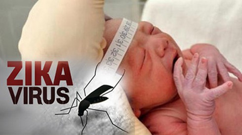 9 thai phụ nhiễm Zika đang được theo dõi tại Bệnh viện Từ Dũ - ảnh 1