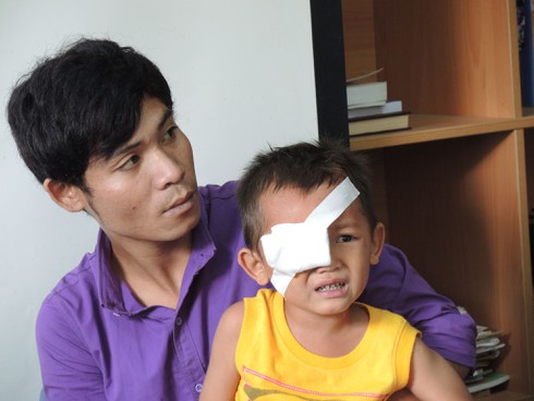 Đùa vui, bắn luôn vào mắt cháu bé 3 tuổi - ảnh 1