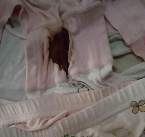 Mẹ bé lớp 1 bị xâm hại tình dục: “Con tôi không bị thương như vậỵ nếu té ngã