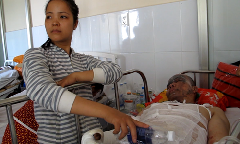 6 công nhân bỏng nặng trong vụ nổ chảo nấu thép tại Bình Dương - ảnh 1