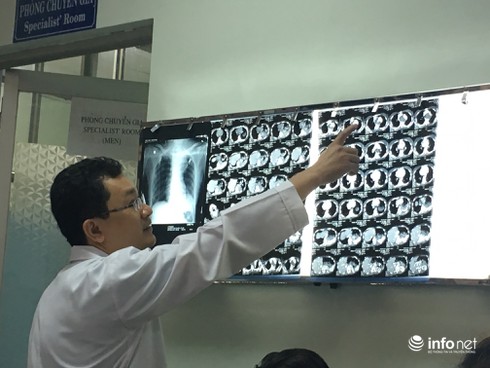 Mổ cấp cứu cứu sống thai phụ vỡ quai động mạch chủ - ảnh 2