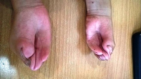 Câu chuyện cổ tích cho cô bé không có ngón tay - ảnh 2