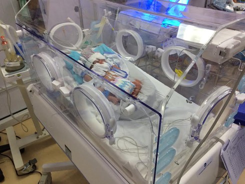 Lần đầu tiên nuôi dưỡng thành công bé sinh non tại bệnh viện quận huyện - ảnh 2