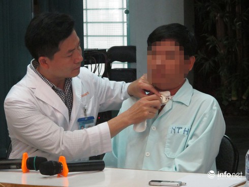 Suýt tử vong vì xương cá - ảnh 1