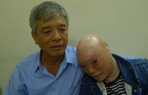 BV Mắt TƯ phẫu thuật thành công ca bệnh khó do ảnh hưởng chất độc màu da cam - ảnh 1