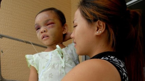 Vụ bé gái bị đánh đập ở Bình Dương: Có thể khởi tố về tội “giết người” - ảnh 3