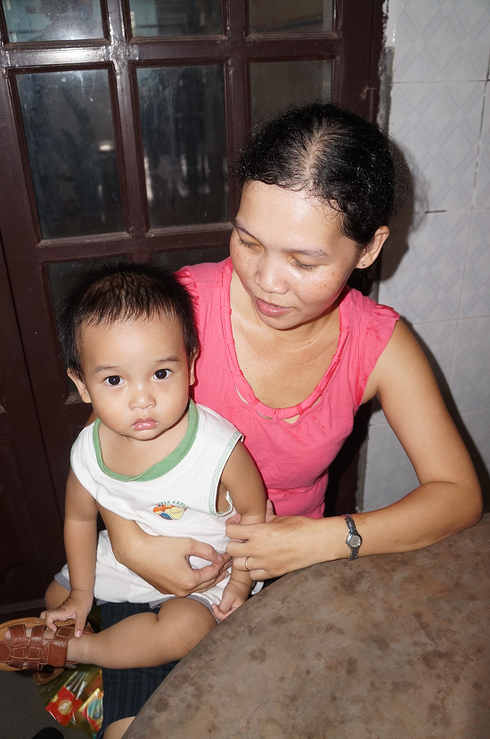 Kinh nghiệm trị rụng tóc sau sinh - ảnh 1