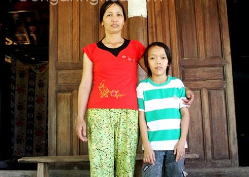 Cậu bé tý hon: 24 tuổi cao 1.1m, nặng 25 kg - ảnh 1