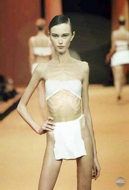 6 người mẫu chết thảm vì biếng ăn - ảnh 3