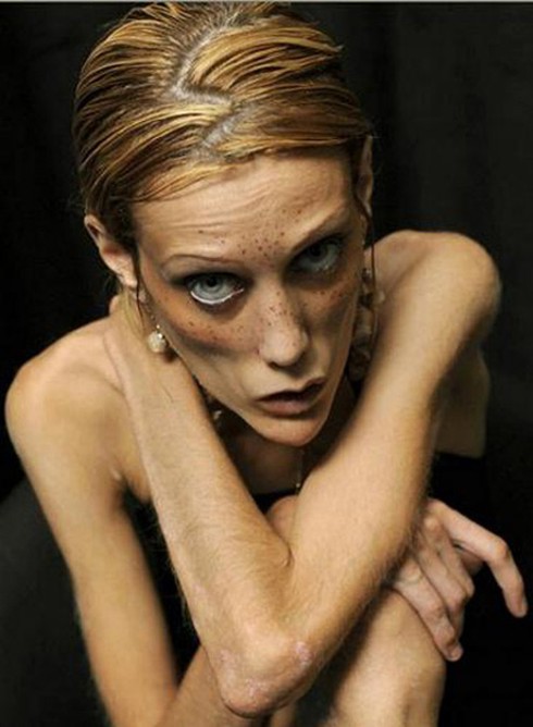 6 người mẫu chết thảm vì biếng ăn - ảnh 8