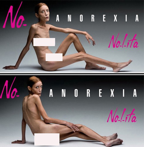 6 người mẫu chết thảm vì biếng ăn - ảnh 9