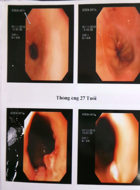 Thanh Hóa: Cứu sống một cảnh sát giao thông ngoại quốc - ảnh 2