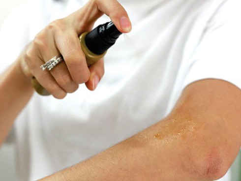 Thuốc giảm đau tại chỗ: Dùng thế nào cho đúng? - ảnh 1