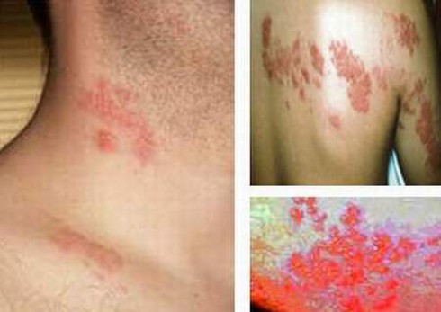 Đọc bệnh qua làn da: Những lưu ý không thể bỏ qua - ảnh 2