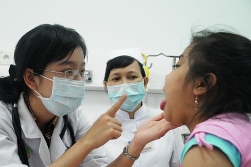 Lưu ý khi điều trị nhiễm khuẩn họng cấp tính ở trẻ - ảnh 1