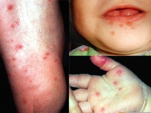 Những căn bệnh dễ lây, nguy hiểm - ảnh 1