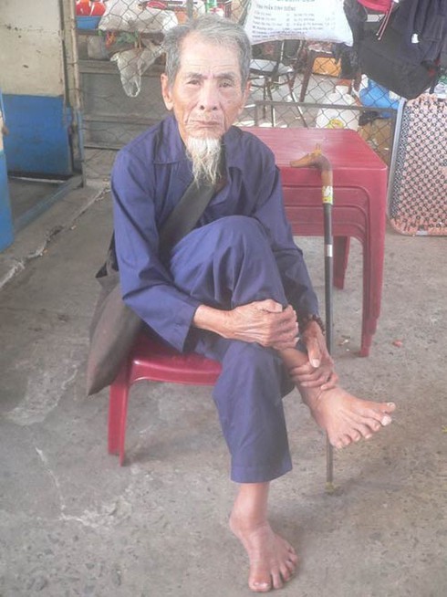 Ông lão sở hữu 26 ngón tay, chân - ảnh 3