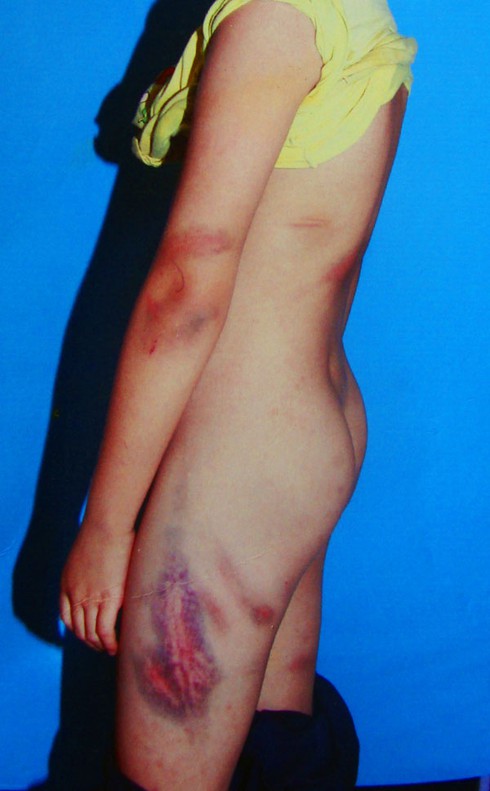 Mẹ kế đánh con chồng lẫn chồng, cả xã phẫn nộ - ảnh 1