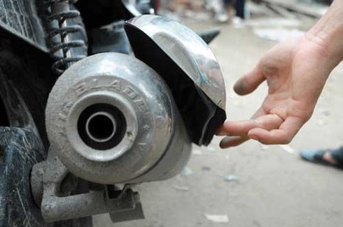 Thêm một nạn nhân bị chắn pô xe máy cắt đứt bàn chân - ảnh 1