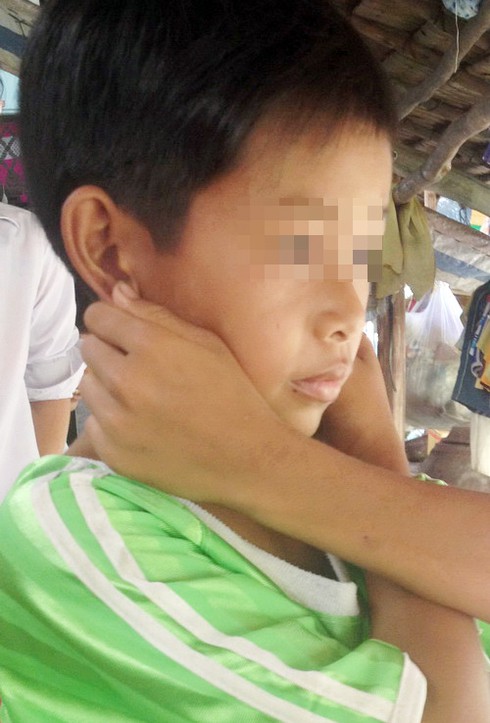 Thầy giáo phạt học trò 'thụt dầu' hàng trăm lần - ảnh 2