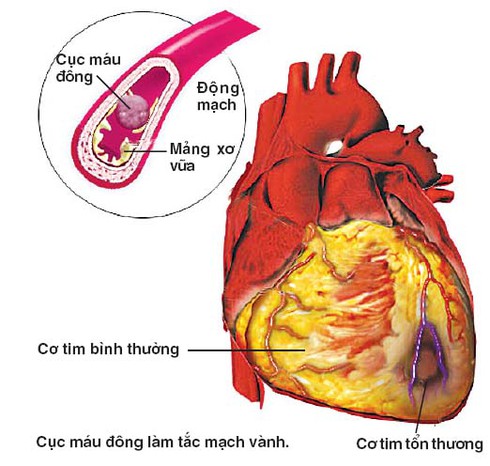 Vì sao đái tháo đường dễ mang thần chết đến với bạn? - ảnh 1