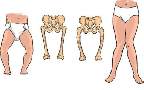 Thiếu canxi ở trẻ: Biểu hiện và tác hại thế nào? - ảnh 1