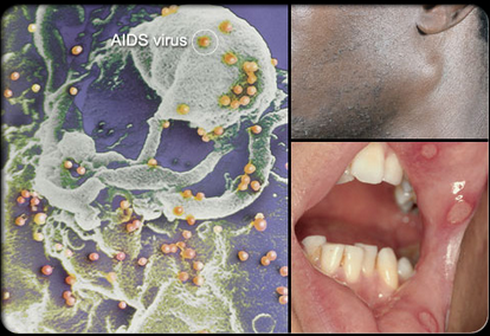 Khiếp đảm những hình ảnh bệnh lây qua đường tình dục - ảnh 9