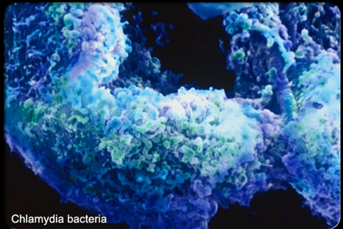 Khiếp đảm những hình ảnh bệnh lây qua đường tình dục - ảnh 6