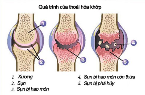 Thảo dược có chữa được đau xương, khớp? - ảnh 1