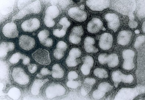 10 virus chết người nguy hiểm nhất thế giới - ảnh 8