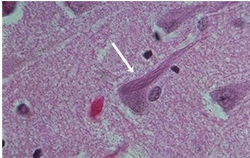 10 virus chết người nguy hiểm nhất thế giới - ảnh 6