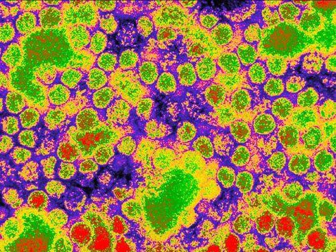 10 virus chết người nguy hiểm nhất thế giới - ảnh 9