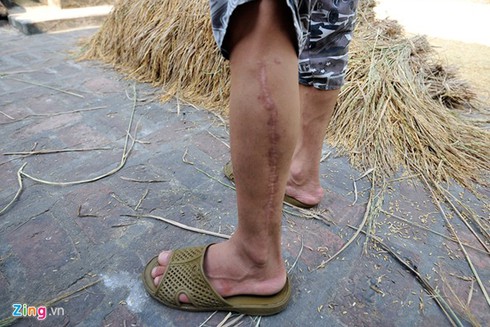 Nam sinh mang gương mặt dị tật vì thay răng - ảnh 11