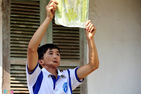 Nam sinh mang gương mặt dị tật vì thay răng - ảnh 12