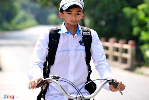 Nam sinh mang gương mặt dị tật vì thay răng - ảnh 7