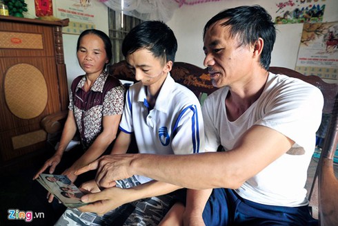 Nam sinh mang gương mặt dị tật vì thay răng - ảnh 8