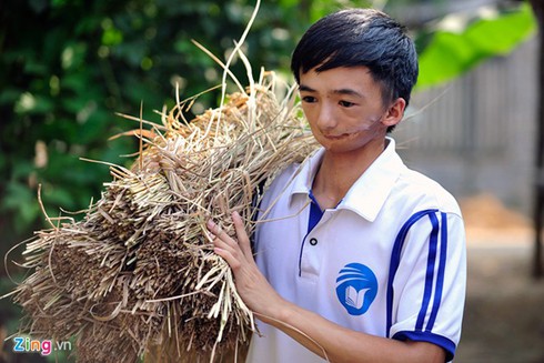 Nam sinh mang gương mặt dị tật vì thay răng - ảnh 9