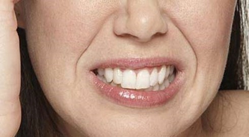 Khắc phục chứng nghiến răng - ảnh 1