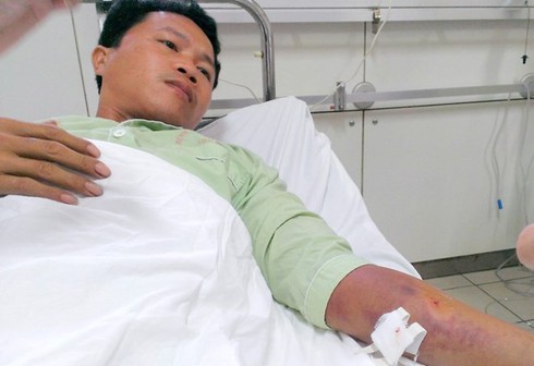 Huế: Rắn lục đuôi đỏ tấn công liên tiếp người dân - ảnh 1