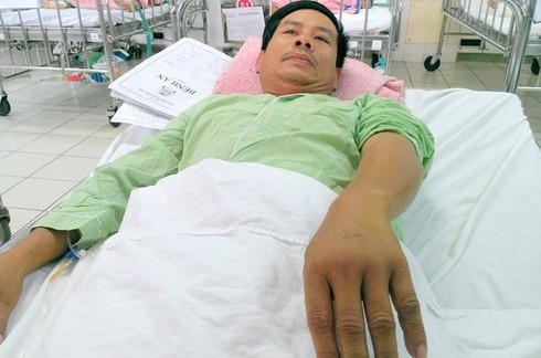 Huế: Rắn lục đuôi đỏ tấn công liên tiếp người dân - ảnh 2