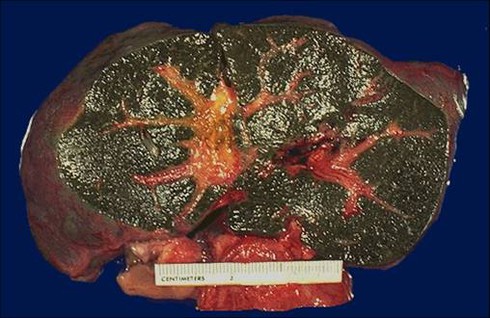 Tổng giám đốc bị chảy máu dạ dày, xơ gan vì rượu - ảnh 2