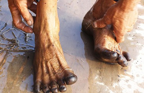 Hiện tượng lạ: Chân đen thui sau lội ruộng - ảnh 1