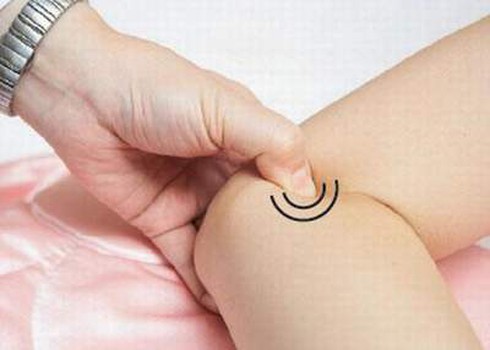 Chữa say nắng bằng y học cổ truyền - ảnh 1