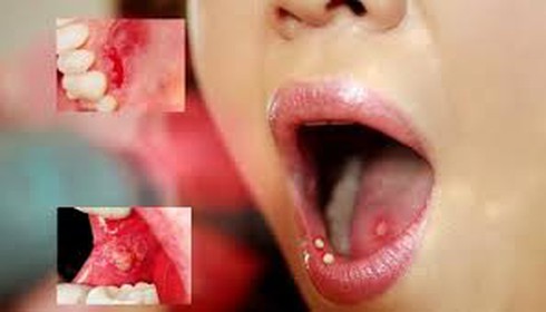 7 vị trí dễ mắc ung thư da mà bạn không ngờ tới - ảnh 1