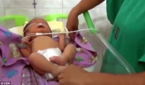 Bé sơ sinh có lỗ mũi như chiếc ống nhỏ - ảnh 2