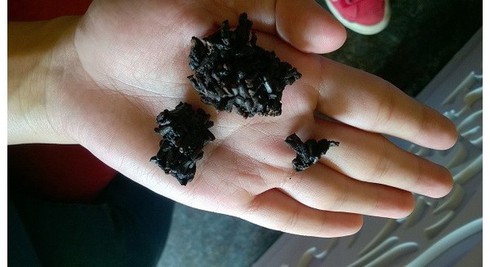 Vụ ăn phải gạo lạ: Đi ngoài và cảm thấy nóng ruột - ảnh 1